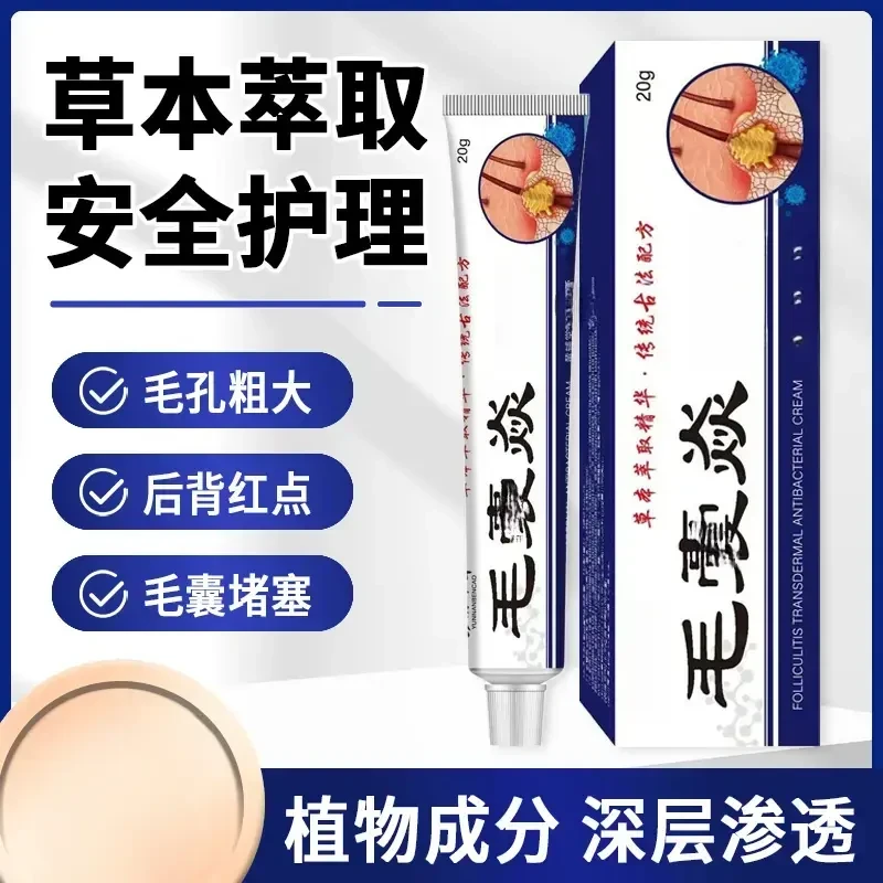 【不满意直接退】毛囊克星深层渗透养护草本植物萃取温和不伤肤