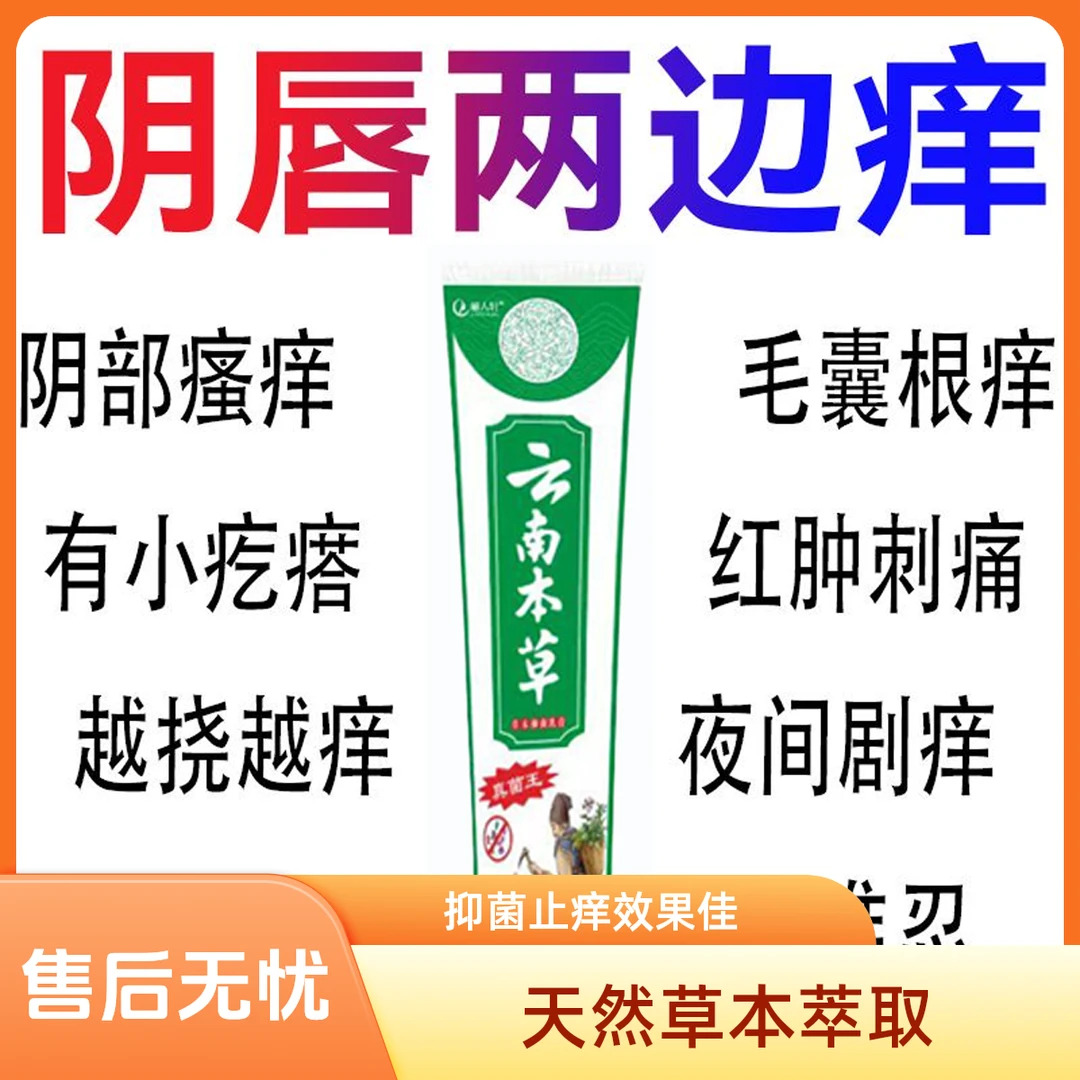 云南本草真菌王女性私处止痒外阴瘙痒老年阴痒阴唇瘙痒草本止痒膏