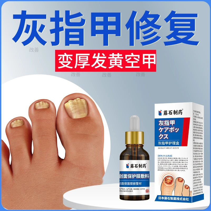 藤石制药灰指甲专用医用护理盒辅助治疗创面保护膜敷料指甲变白发黄增厚真菌感染引起凹凸不平手指脚趾甲疼痛修复液指甲辅助Q2