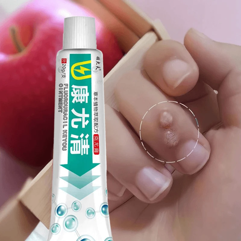 手上长疙瘩刺瘊子手指肉刺球手足凸起寻常疙瘩粗糙肉钉外用膏l