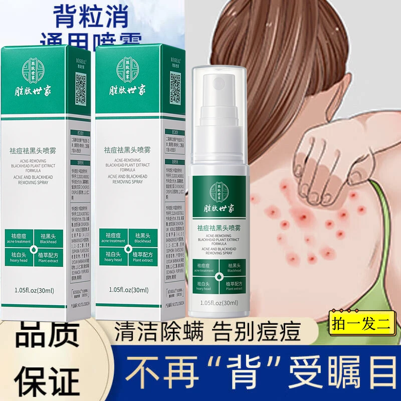 【拍一发2】后背祛痘身体喷雾消除神器淡化痘印胸背上痘痘去除产品