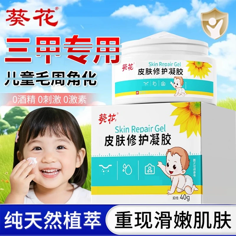 小孩脸上长小颗粒鸡|皮肤毛周角化儿童小痘痘毛|囔角化药膏去角质
