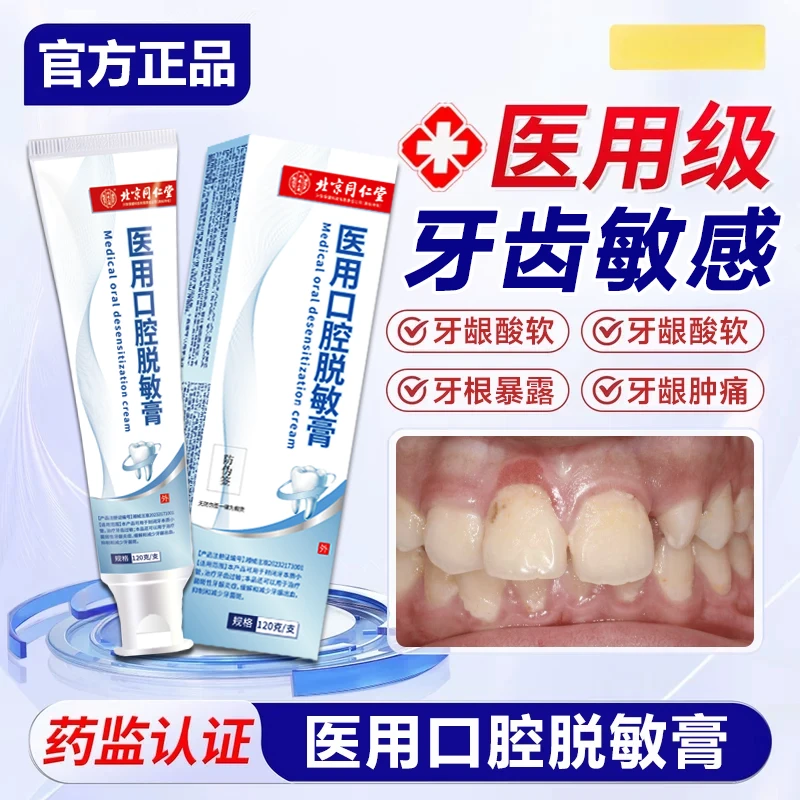内廷上用牙齿脱敏凝胶正品牙龈敏感酸软牙龈出血牙周炎牙髓痛智齿痛制牙菌斑医用口腔脱敏膏