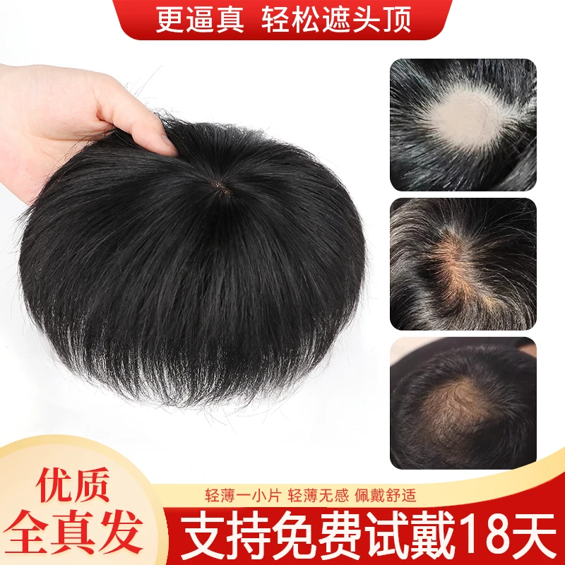 假发男头旋脱发全真人发丝补发片头顶稀少遮盖斑秃疤痕男士假发片