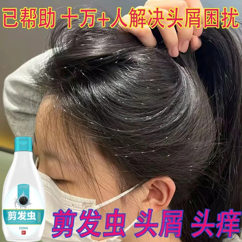 去剪发虫洗发水小孩成人除螨虫卷发虫吃发虫专业袪头屑止痒洗发露