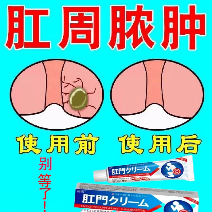 肛周.脓.肿.肛周.疼.痛.肛.瘘.硬.块.草本温和