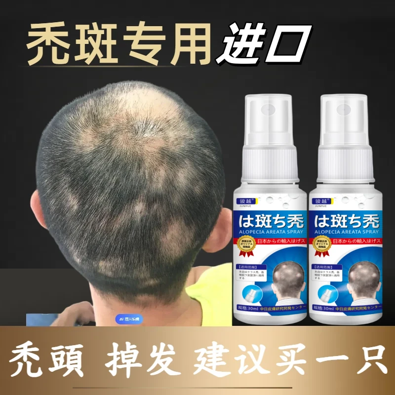 秃头喷剂掉头发严重班禿秃顶头发稀少禿斑护理喷剂草本身体护理