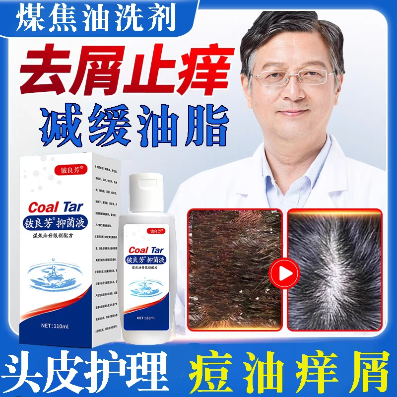 【止痒去屑】煤焦油洗剂去屑止痒洗发水凉爽头皮痘脂溢性抑护洗发液