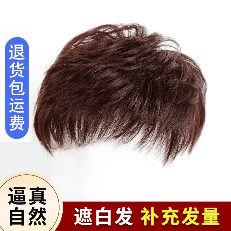 头顶补发片女透气网假发片纹理发妈妈中老年发套小卷烫真发补发块