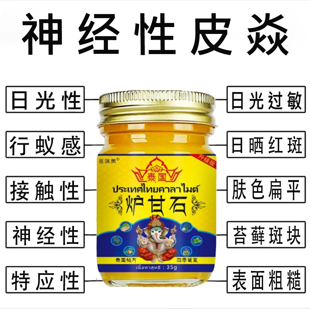 神经性/皮焱/日光/性脂溢性/神经性/日光过敏/日晒红斑止痒
