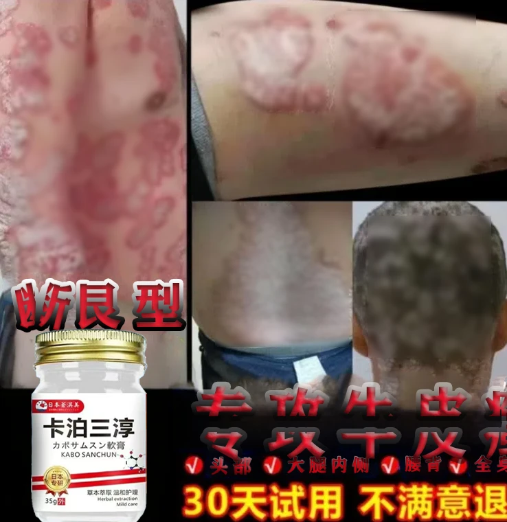 【卡泊三淳】牛.皮.鲜.手.足.鲜.股.鲜.大腿