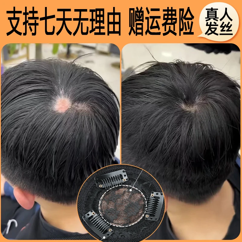 疤痕补发男士假发头顶增发量斑秃透气小面积全真发丝补发假发片