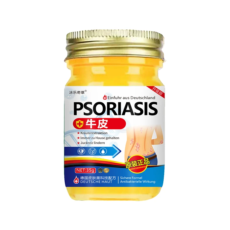 全身牛/皮/银/屑/鲜手足头体股/大腿内侧草本止痒膏
