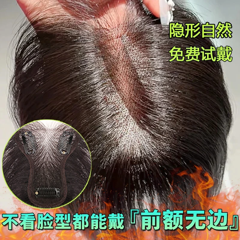前额无边假发女片头顶补发增发量蓬松高颅顶无痕遮白发真发假发片