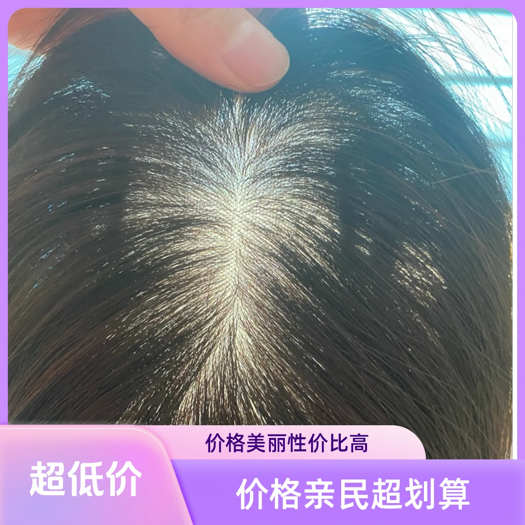 9*14补发片女真人发增发天然真发遮白发不用戴发网真发假发片