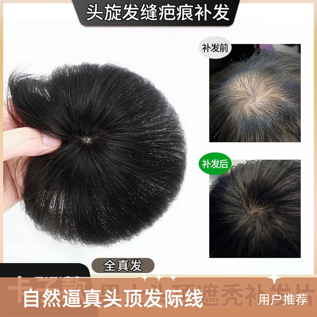 假发男头旋发缝疤痕补发片递针旋全真发头顶遮斑秃脱发男士假发片