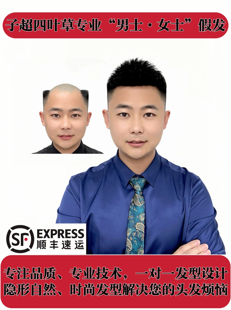 D4递针前额孵化漂扣（可做任何发型）