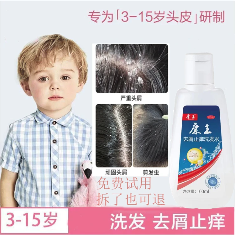 康I王儿童止痒去屑洗发水正品100mI女孩去屑止痒控油康主洗头露