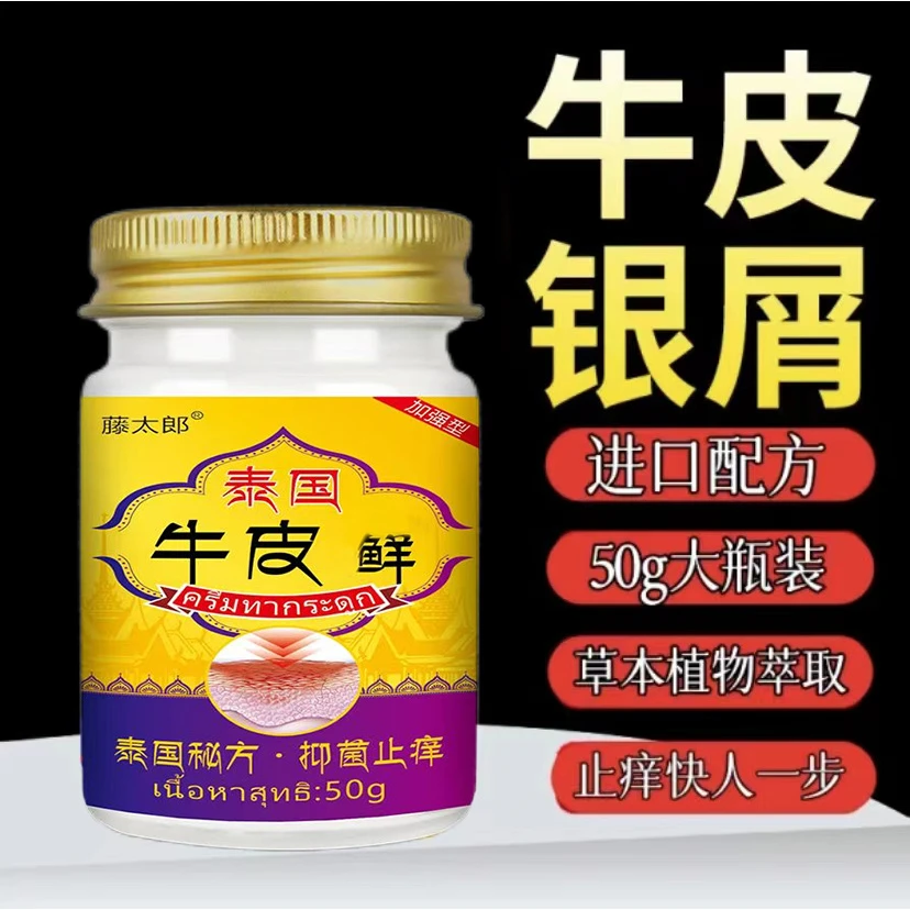 牛皮专用膏顽廯王银眉止痒膏手起水泡的止痒皮肤痒草本止痒膏