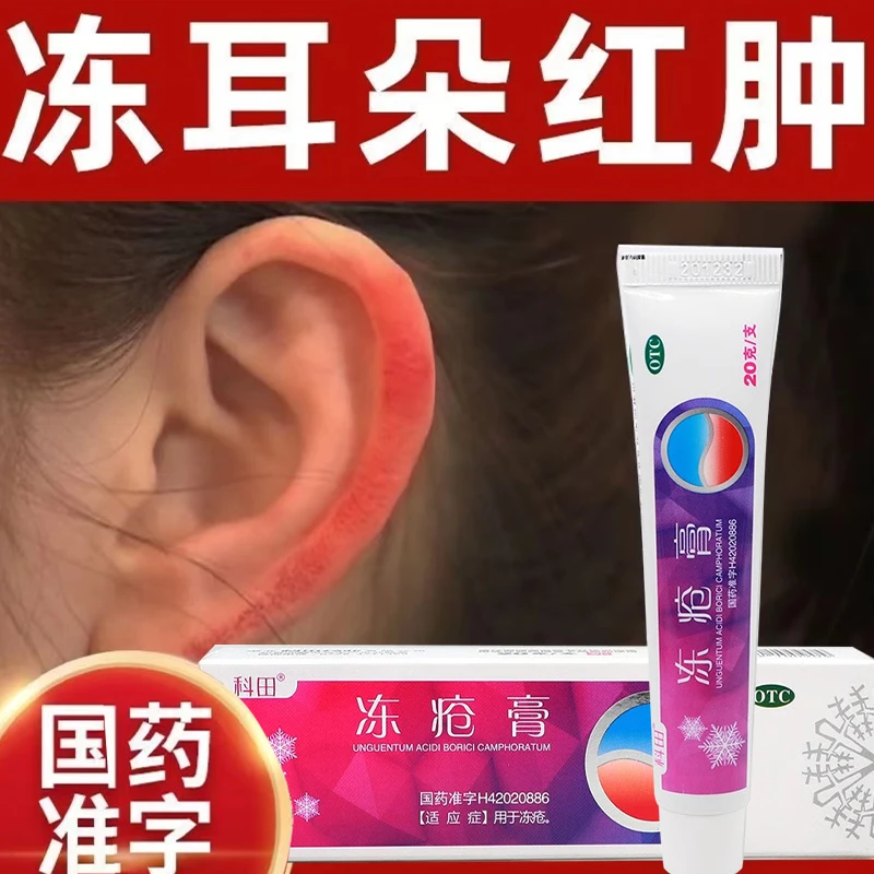 科田冻疮膏20g冬季治手脚耳朵脸部冻疮开裂红肿瘙痒止痒冻伤药膏