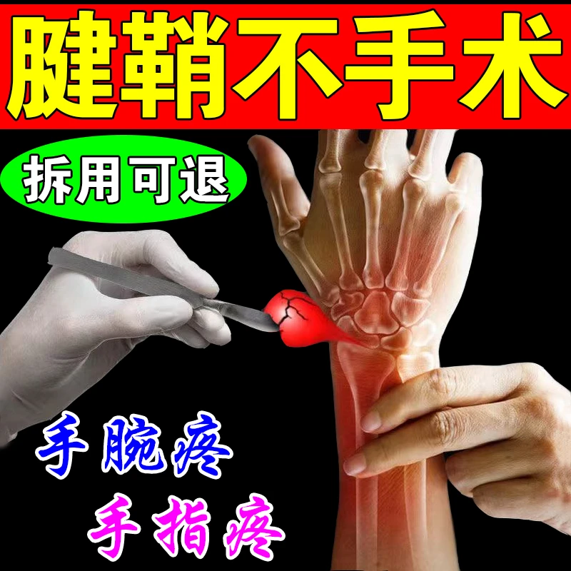 腱鞘炎穴位压力刺激贴艾草舒筋贴膏药手腕手指疼痛鼓包飞纯度