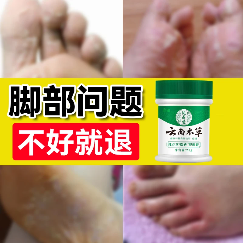 止痒膏去脚出汗脱皮起水炮干裂脚趾缝痒抑菌止痒神器