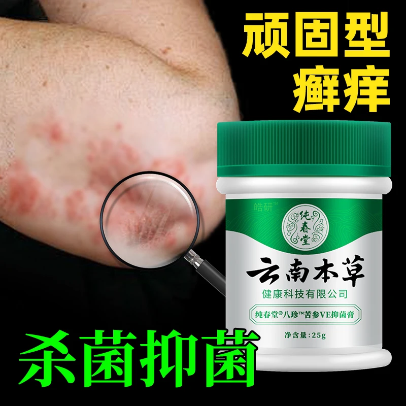 牛-皮草本膏银屑止痒膏皮肤仰菌止痒手痒脚痒植物草本膏