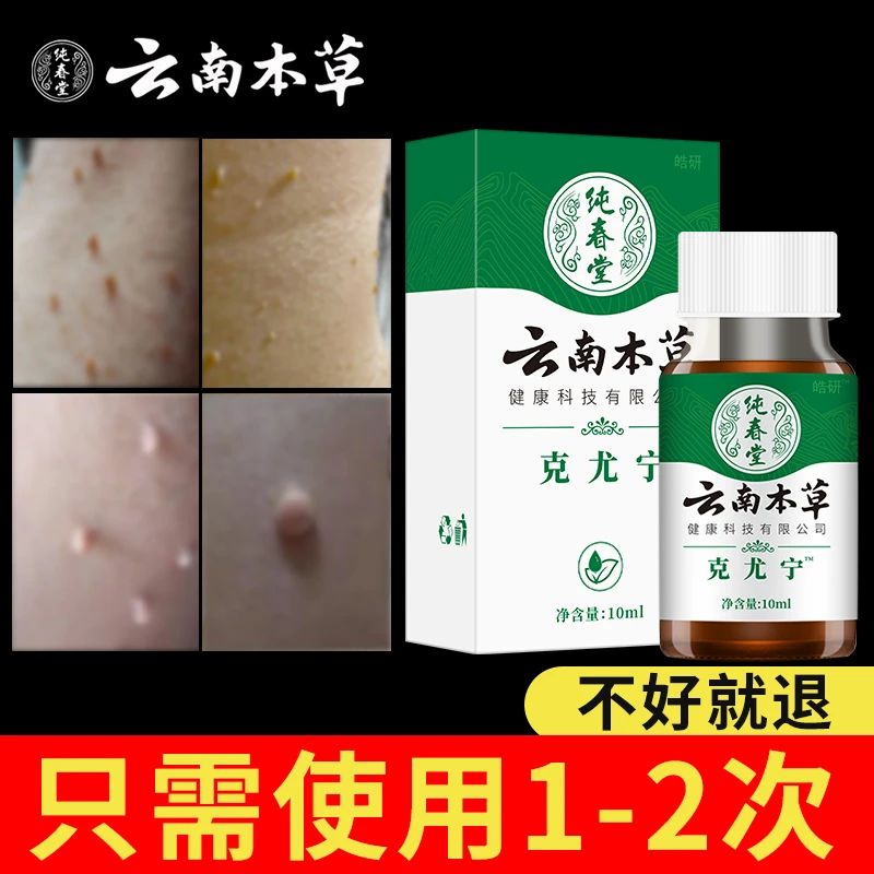 【小肉粒专用】正品脖子丝状扁平寻常肉刺手足腋下全身上泡脚抑菌