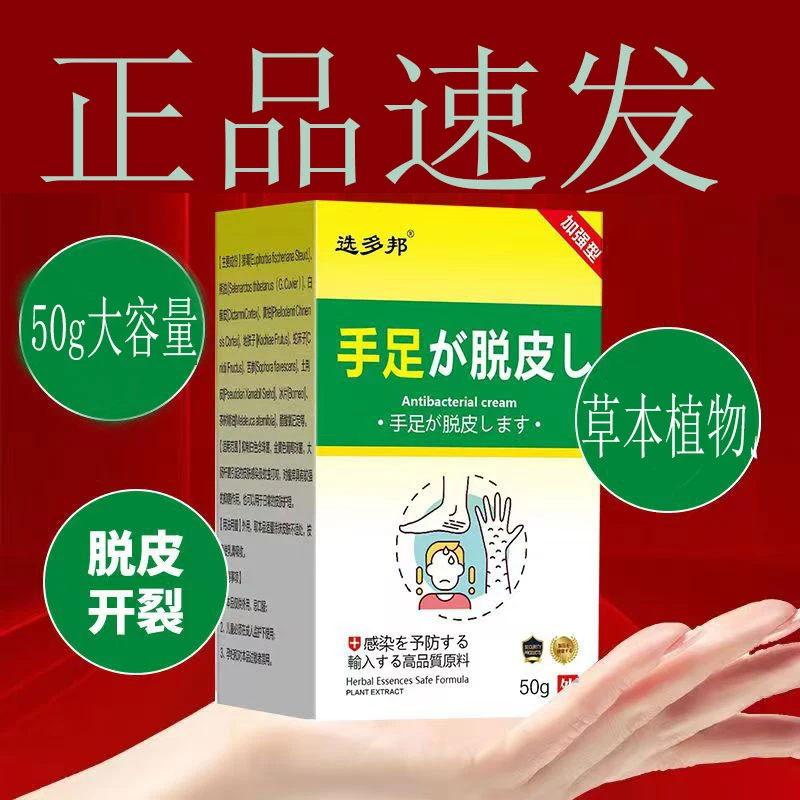 手脱皮专用乳膏手上手真痒菌感染的克星汗泡膏汗珍泡膏手指起水泡