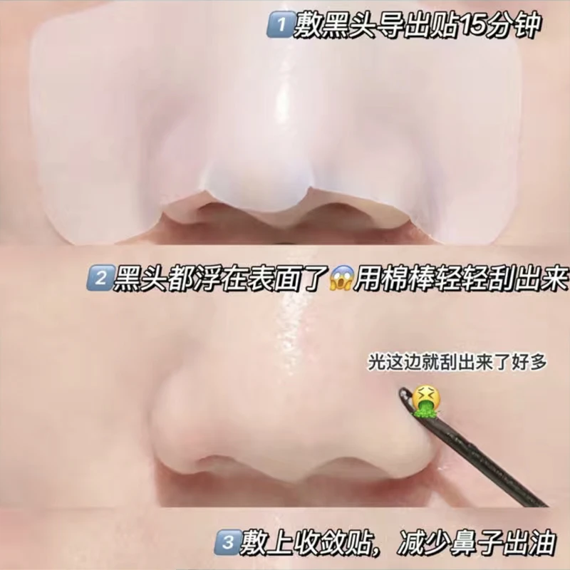 鼻贴三件套 去黑头粉刺闭口 导出液收缩毛孔 深层清洁 男女通用