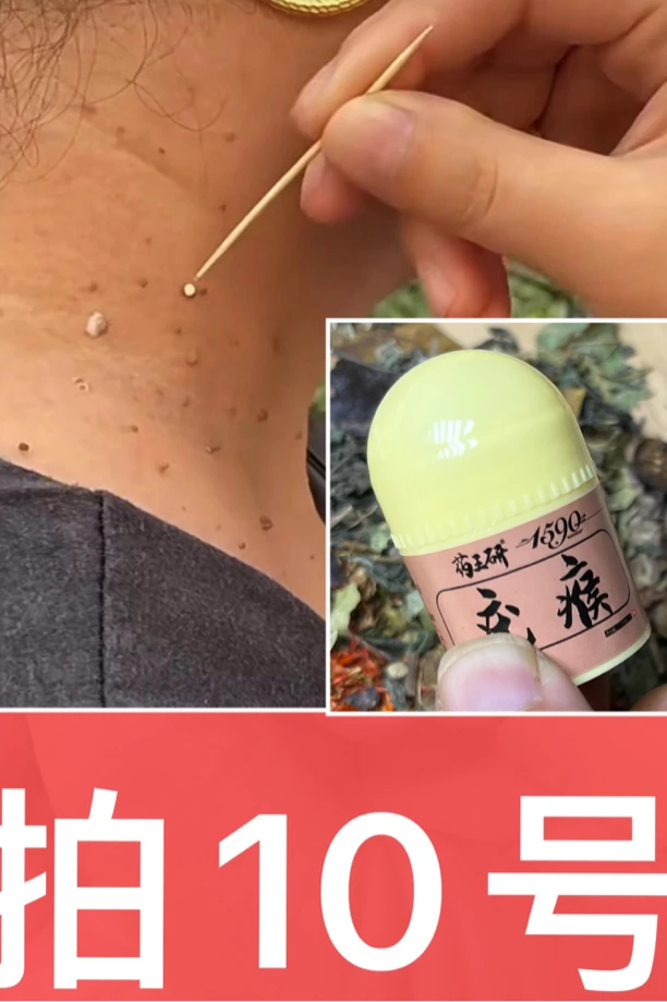 尤植物草本温和15克(手工自熬)小膏