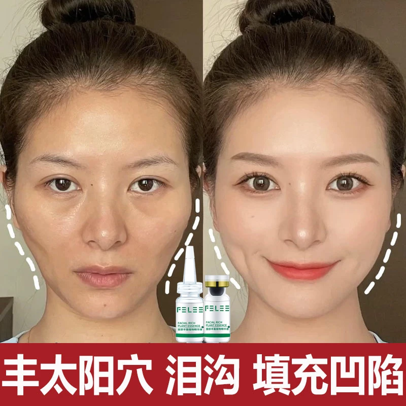【脸部凹陷修护】丰太阳穴泪沟法令纹皱纹面部丰盈精华液填充粉神器