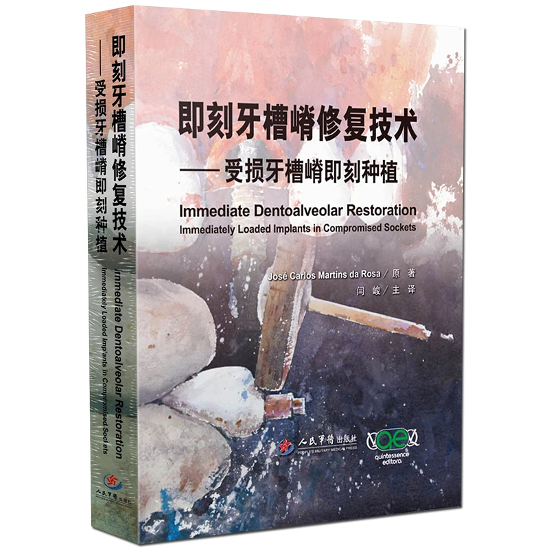 即刻牙槽嵴修复技术/受损牙槽嵴即刻种植