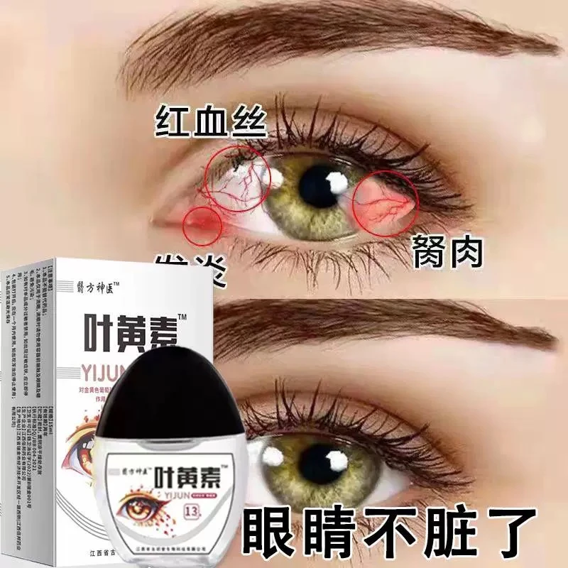 【拍一发四瓶】叶黄素滴眼液舒缓清洗眼部温和清凉缓解眼疲劳干涩