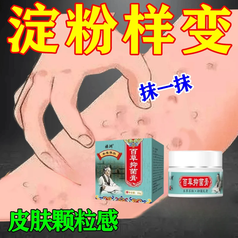 淀粉样变原继发性皮肤变粗糙颗粒状痒脱皮黑色素鳞外祺洲本草乳膏