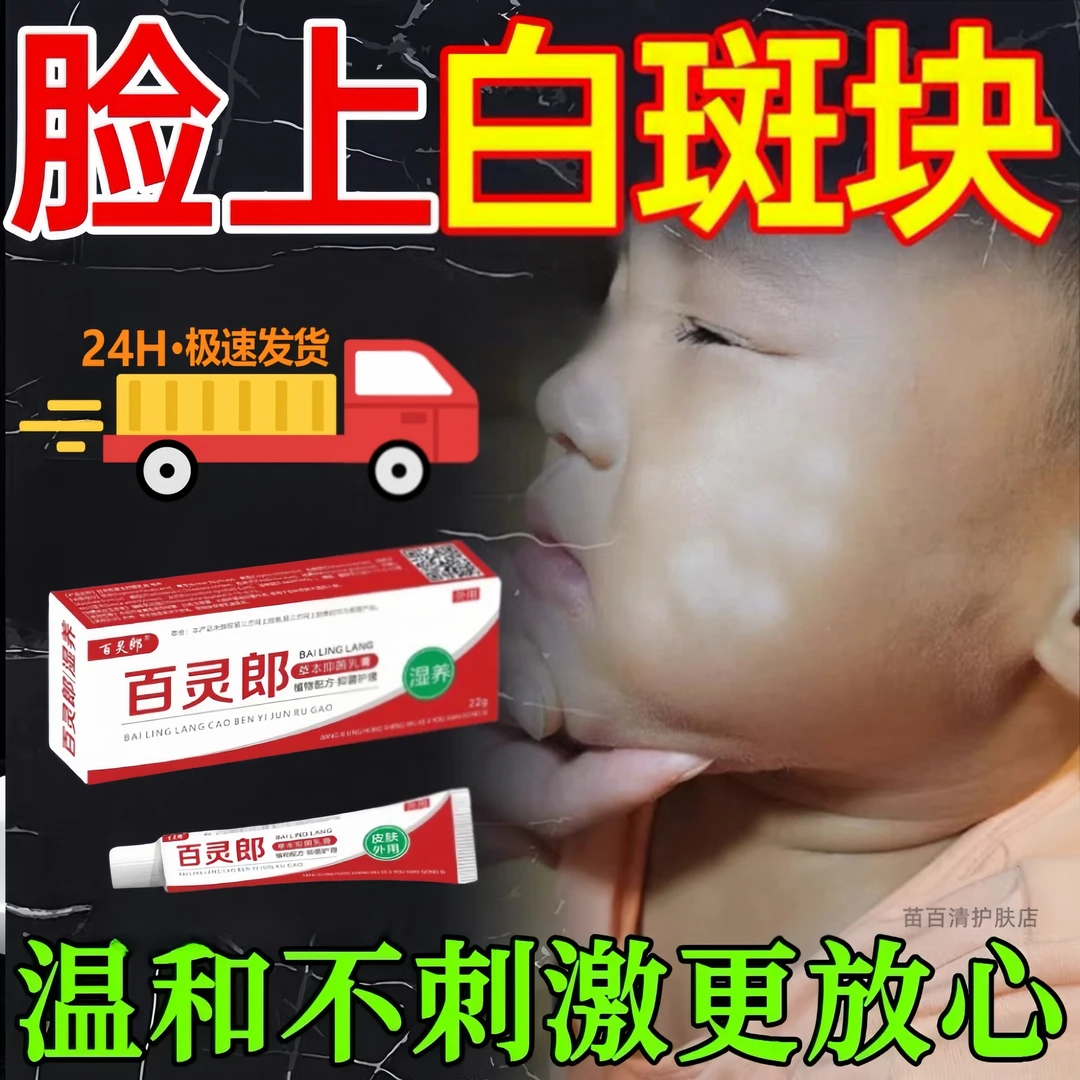 白色糠疹儿童用脸上长白斑去汗斑桃花藓皮肤痒虫长藓修复BL百灵膏
