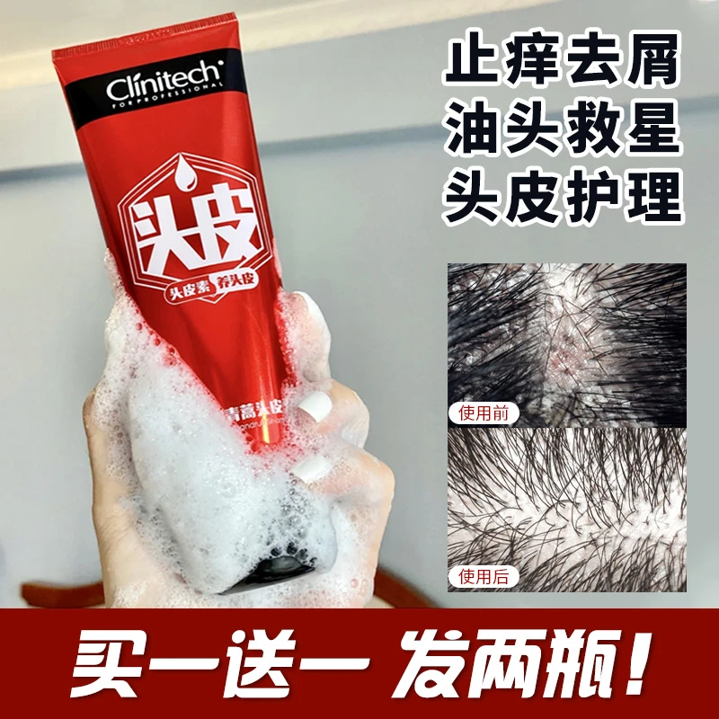 买一送一/科丽尼青蒿头皮素控油止痒去屑修护洗发水按摩膏深层