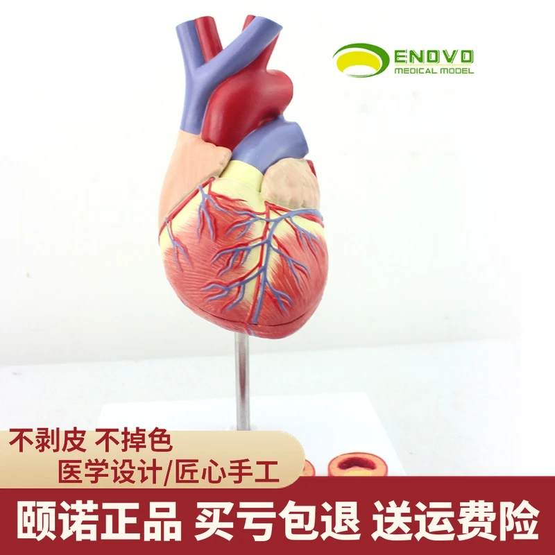 ENOVO颐诺 1:1医学人体心脏模型冠状动脉血栓心内科教学