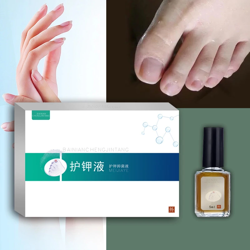 灰祉甲抑菌液坏甲厚甲亮甲脱甲专用
