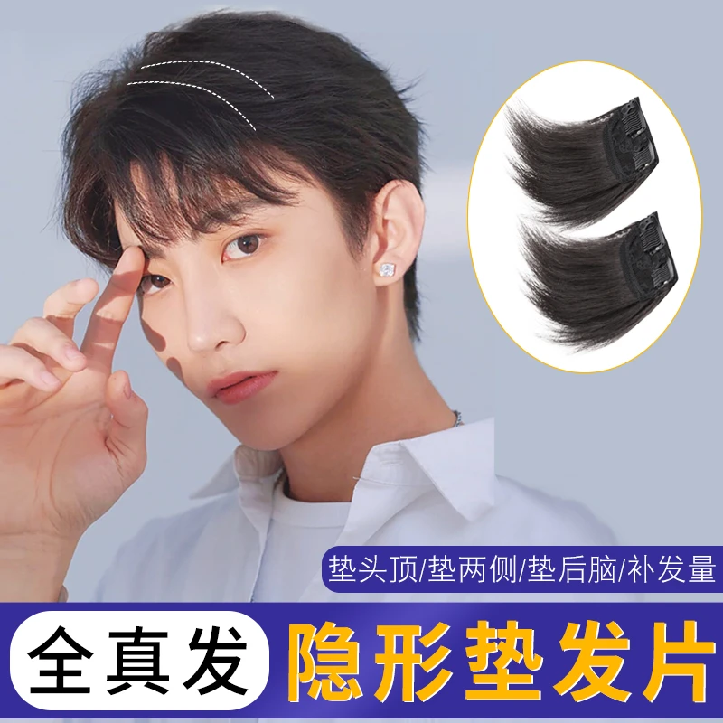 男士补发片高质量假发男全真发假发片隐形无痕前额补发M型增发量