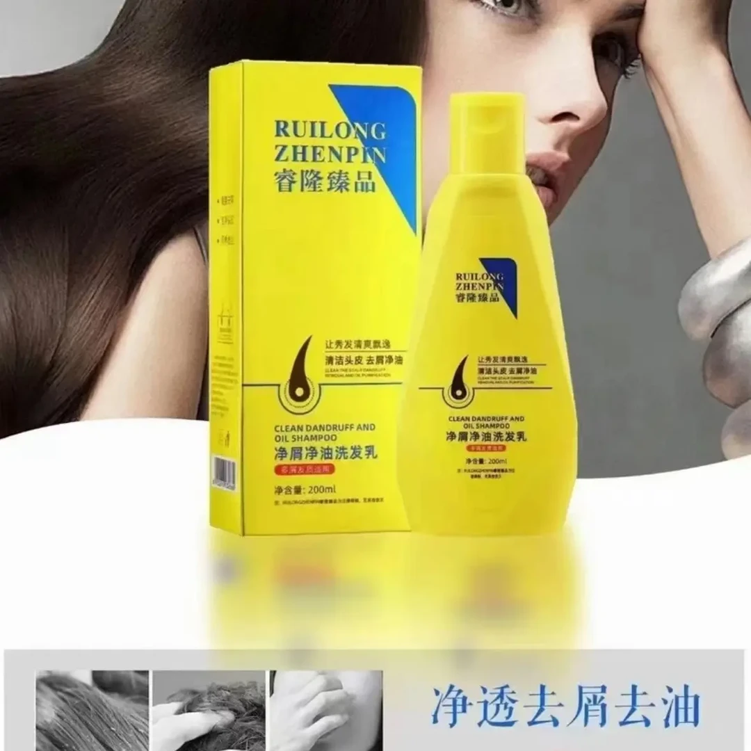 二硫化硒去屑止痒控油洗发露毛囊清洁去油发质蓬松温和不刺激