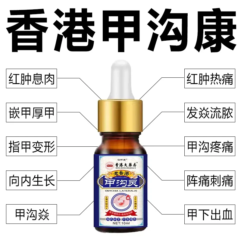 指甲长肉里甲沟肿大有脓包软甲脱甲脚指甲化脓脚趾头专用甲沟液