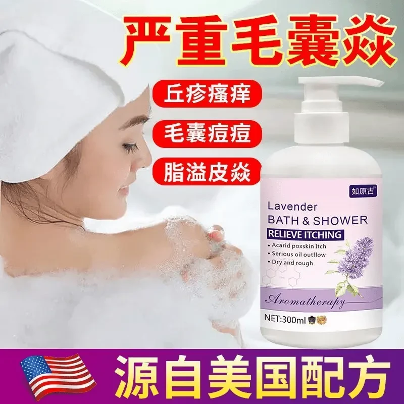 【官方正品】马拉色菌毛囊专用沐浴露胸背头部逗/逗止痒专用膏温和