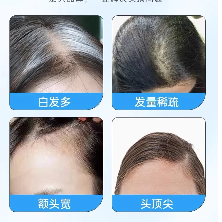 【爽】全真发孤品补发片，跟着主播讲解下单v