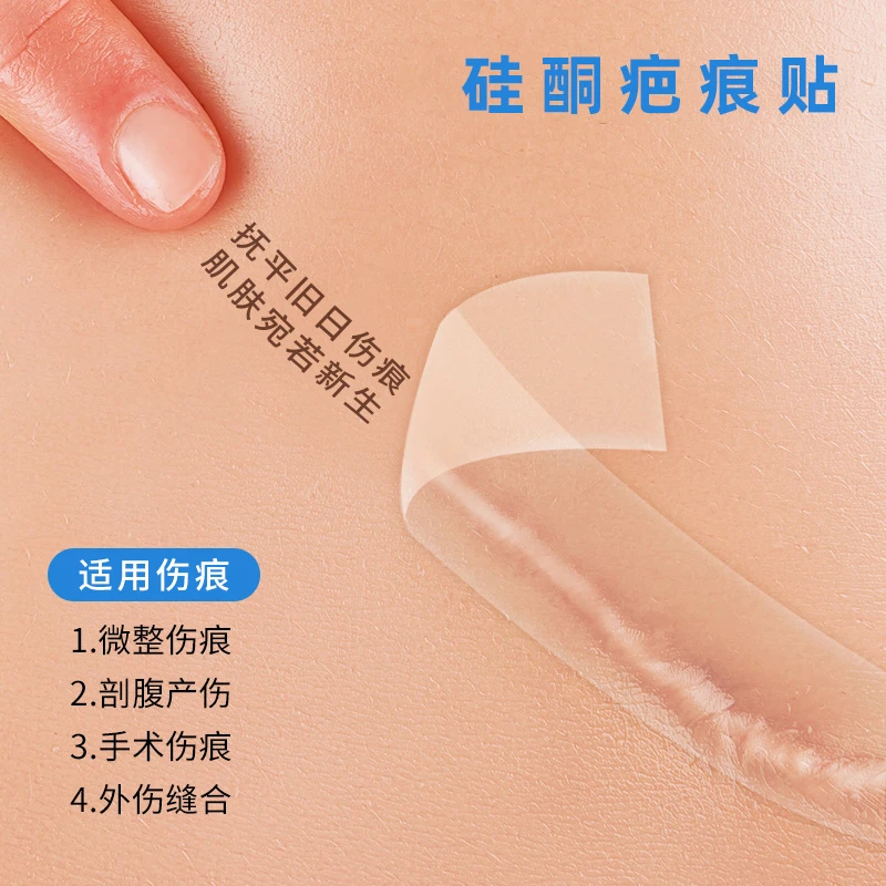 疤痕贴剖腹产甲状腺手术外伤缝针烧烫增生凸起硅酮凝胶修复祛疤贴