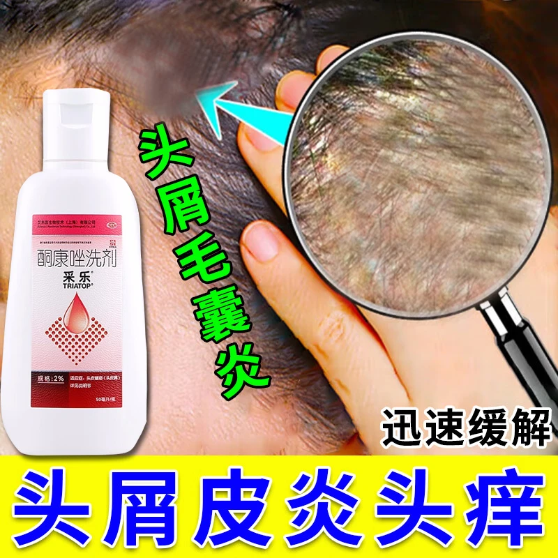 采乐酮康唑洗剂2%*50ml治头皮屑花斑癣脂溢性皮炎皮肤瘙痒洗发剂