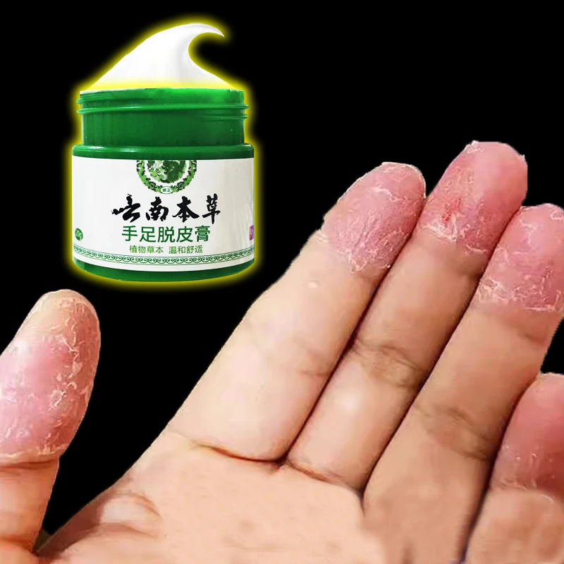 云南本草膏手足脱皮膏草本精粹外用手脚部脱皮干裂抑菌止痒干软膏