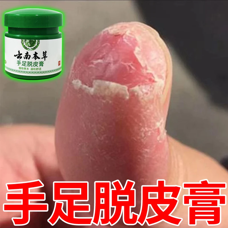 云南本草膏手足脱皮膏草本精粹外用手脚部脱皮干裂抑菌止痒干软膏