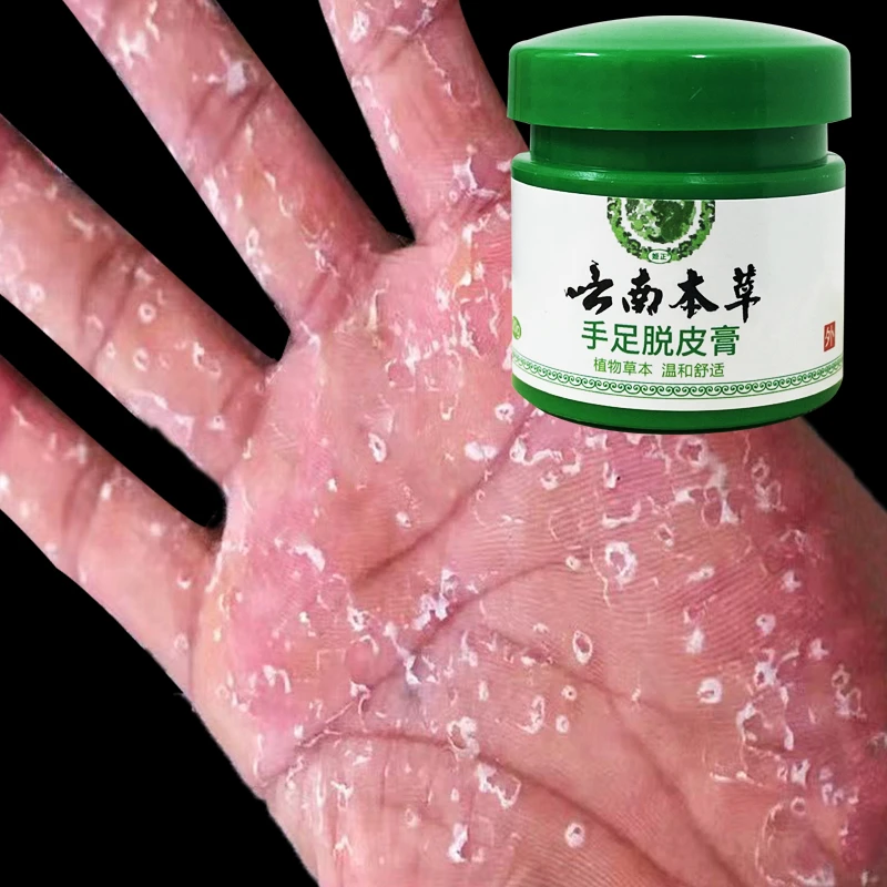 云南本草膏手足脱皮膏草本精粹外用手脚部脱皮干裂抑菌止痒干软膏