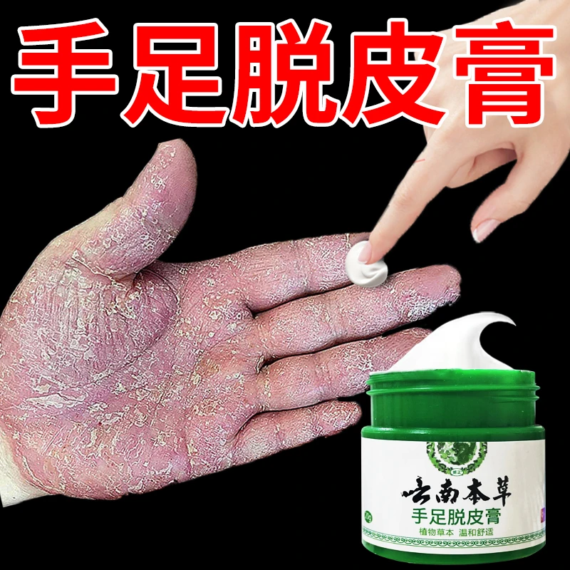 云南本草膏手足脱皮膏草本精粹外用手脚部脱皮干裂抑菌止痒干软膏
